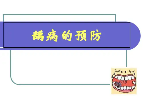 口腔预防医学-龋病预防
