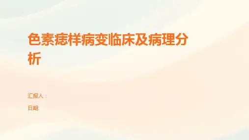 色素痣样病变临床及病理分析