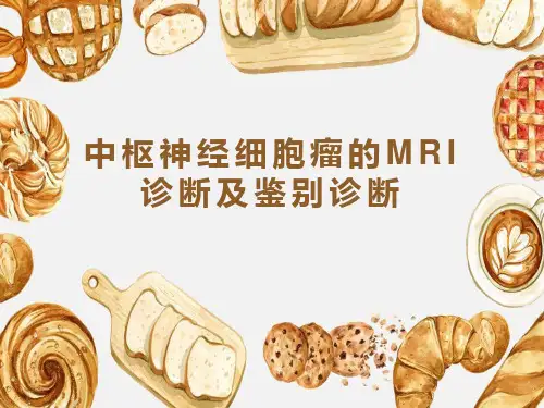 中枢神经细胞瘤的MRI诊断及鉴别诊断