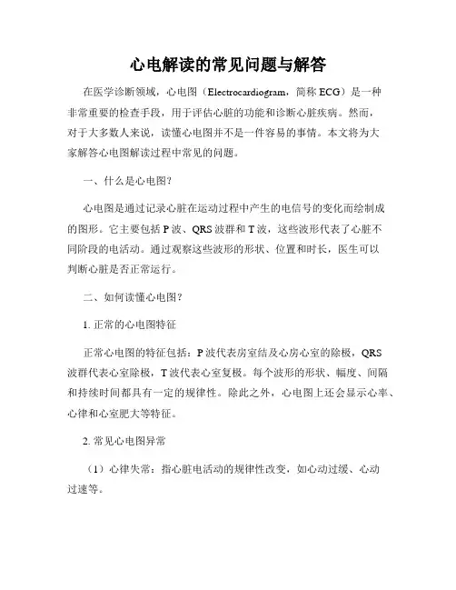 心电解读的常见问题与解答