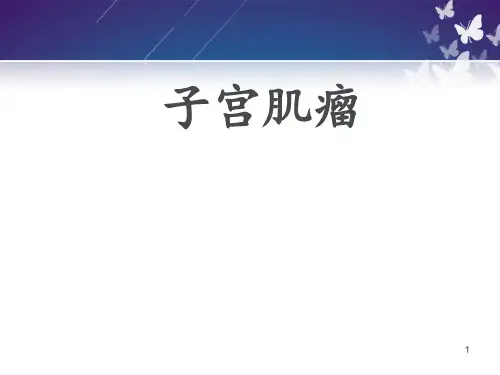 子宫肌瘤【妇科】  ppt课件