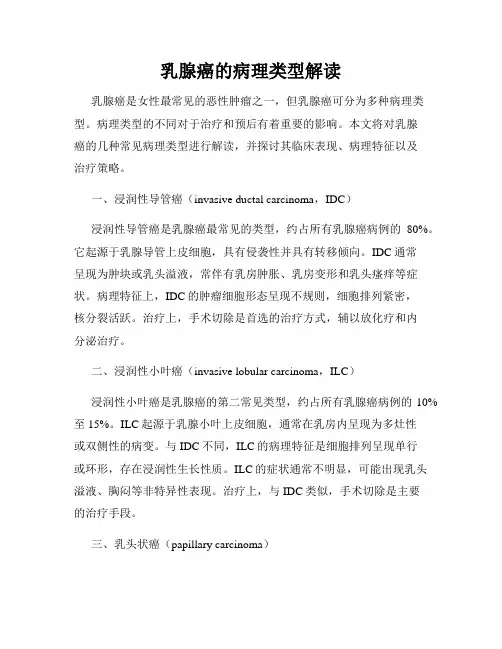 乳腺癌的病理类型解读