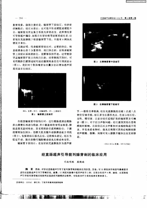经直肠超声引导前列腺穿刺的临床应用