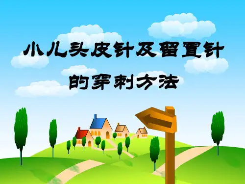 小儿头皮针剂留置针穿刺方法