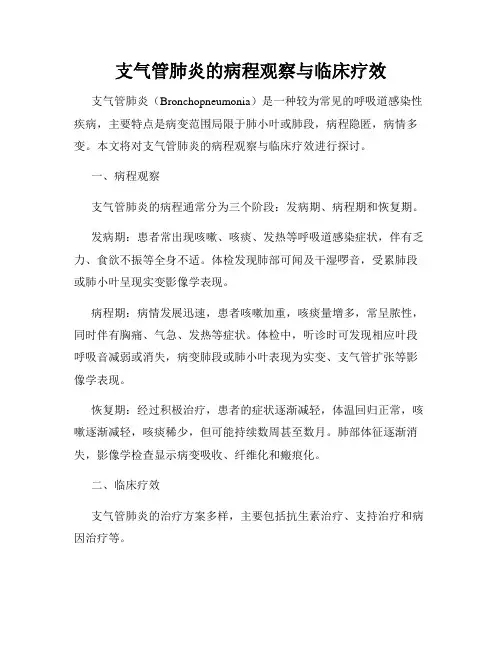 支气管肺炎的病程观察与临床疗效