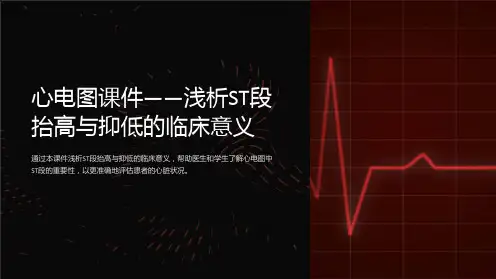 “心电图课件-浅析ST段抬高与抑低的临床意义”