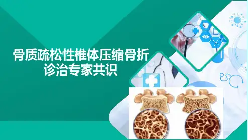 骨质疏松性椎体压缩骨折诊治专家共识
