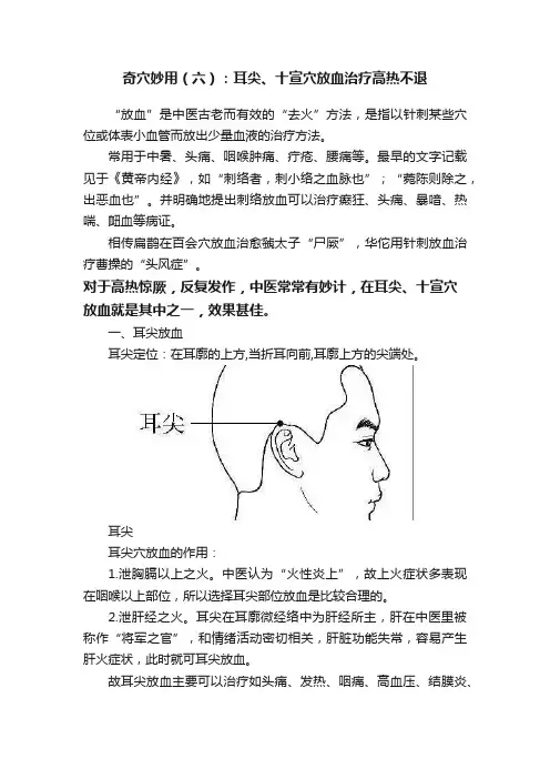 奇穴妙用（六）：耳尖、十宣穴放血治疗高热不退