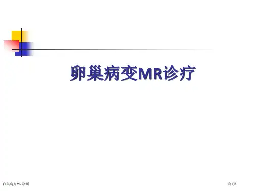 卵巢病变MR诊断