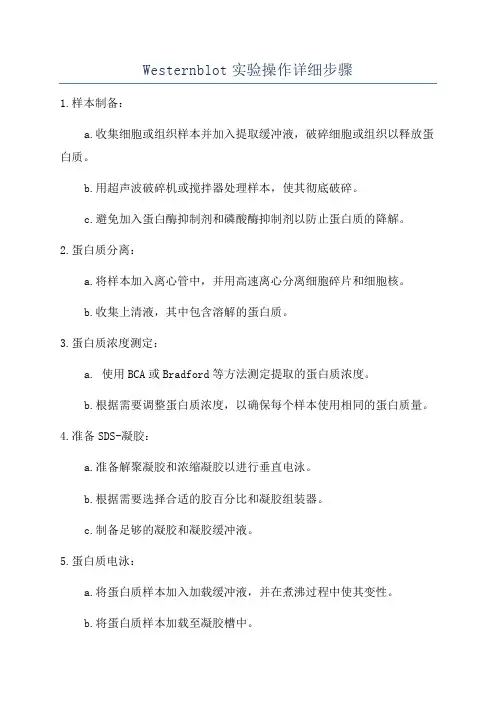 Westernblot实验操作详细步骤