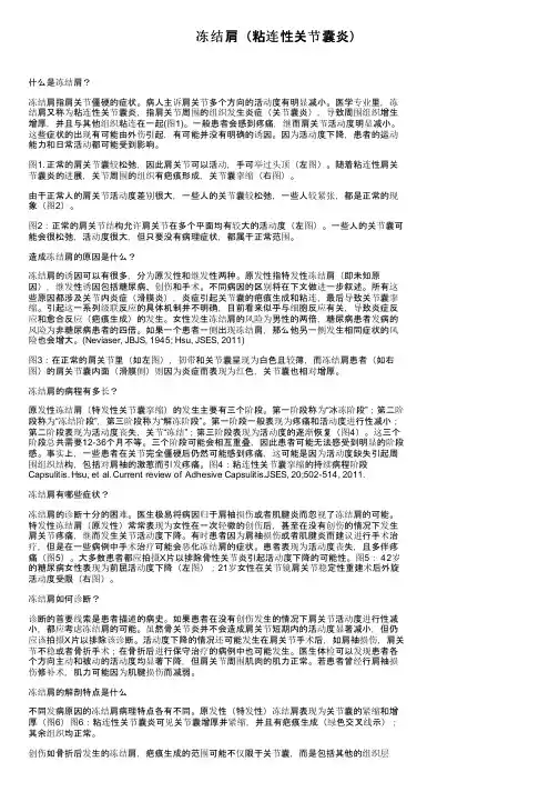 冻结肩（粘连性关节囊炎）