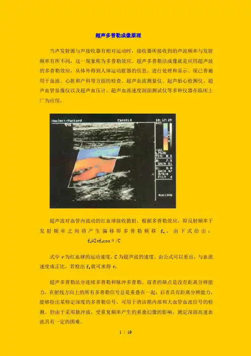 超声多普勒成像原理