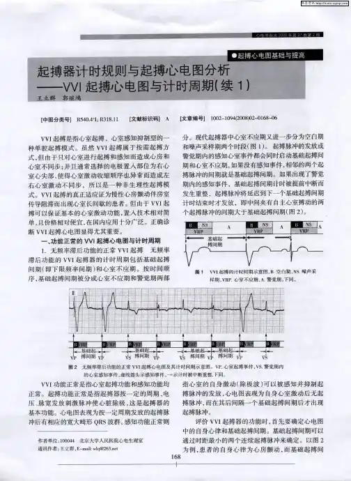 起搏器计时规则与起搏心电图分析——VVI起搏心电图与计时周期(续1)