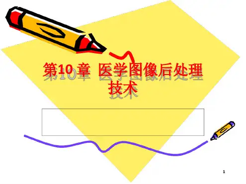 医学图像后处理技术ppt课件