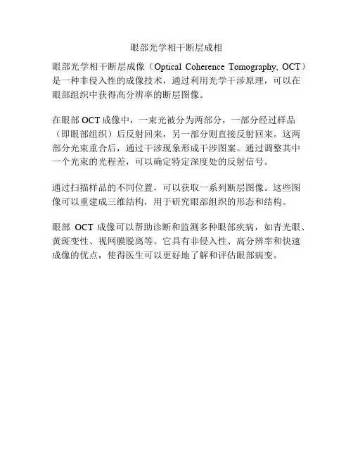 眼部光学相干断层成相
