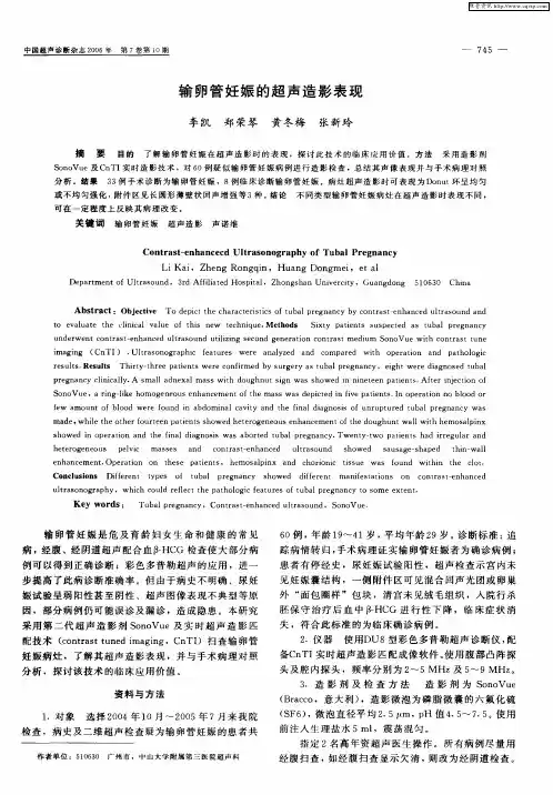 输卵管妊娠的超声造影表现