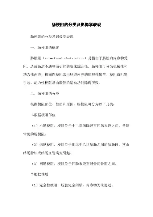 肠梗阻的分类及影像学表现