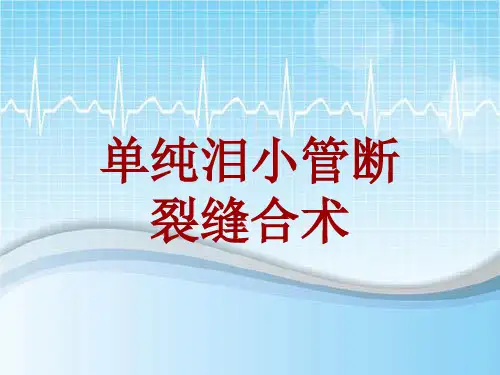 手术讲解模板：单纯泪小管断裂缝合术