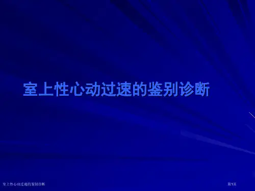 室上性心动过速的鉴别诊断