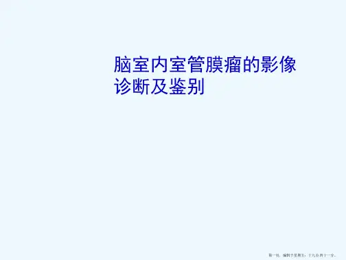 脑室内室管膜瘤的影像诊断及鉴别
