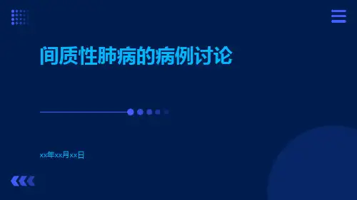 间质性肺病的病例讨论