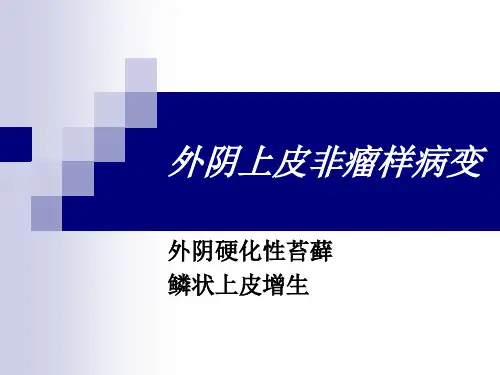 外阴上皮非瘤样病变
