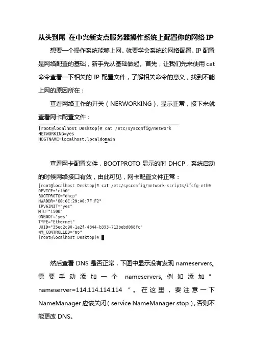 从头到尾 在中兴新支点服务器操作系统上配置你的网络IP