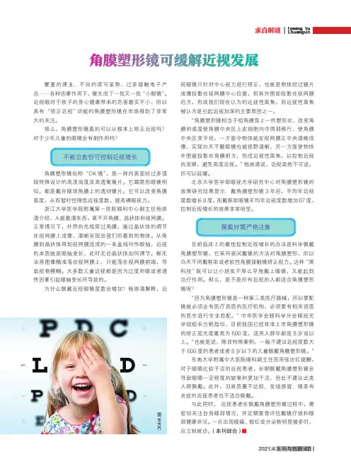 角膜塑形镜可缓解近视发展