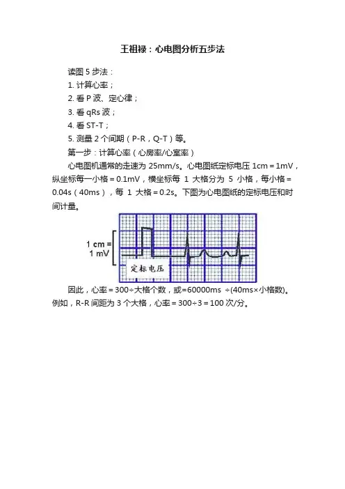 王祖禄：心电图分析五步法