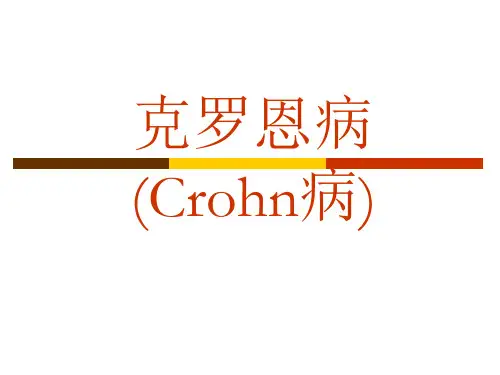 Crohn病 PPT课件
