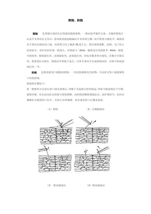 基本手术操作之剪线