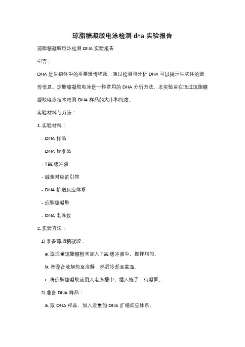 琼脂糖凝胶电泳检测dna实验报告