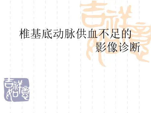 医学-椎基底动脉供血不足影像诊断