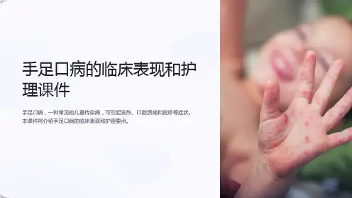 手足口病的临床表现和护理课件