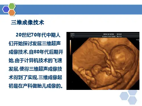 2.397.5三维成像技术医学影像设备学
