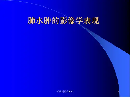 肺水肿的影像学表现ppt课件【100页】