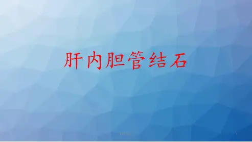肝内胆管结石  ppt课件