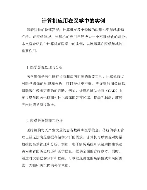 计算机应用在医学中的实例