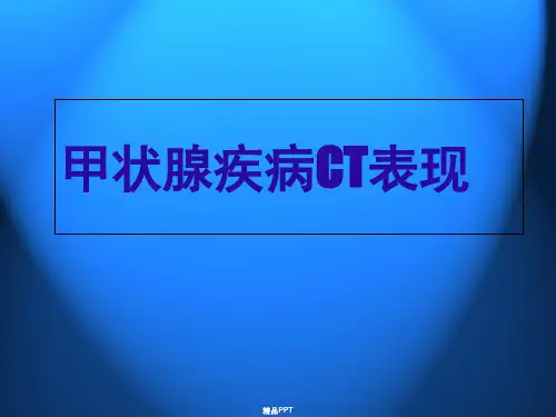 甲状腺疾病CT表现