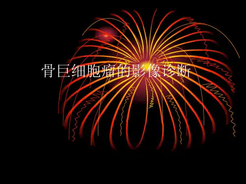 骨巨细胞瘤的影像诊断.ppt