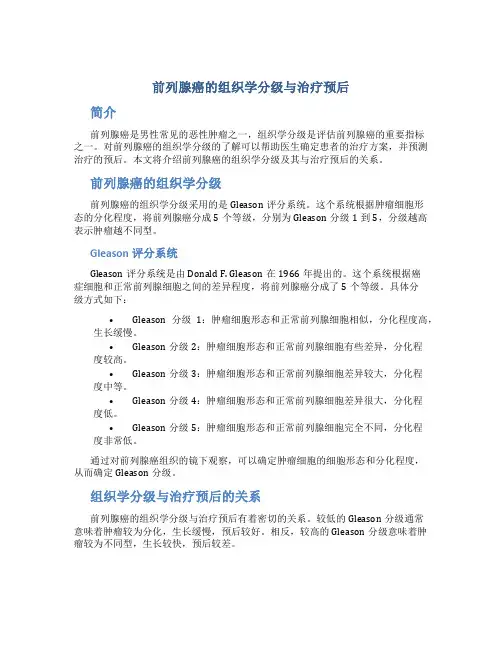 前列腺癌的组织学分级与治疗预后