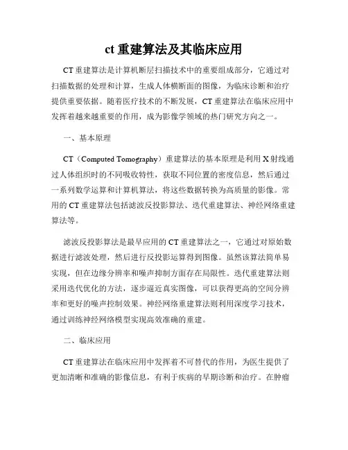 ct重建算法及其临床应用