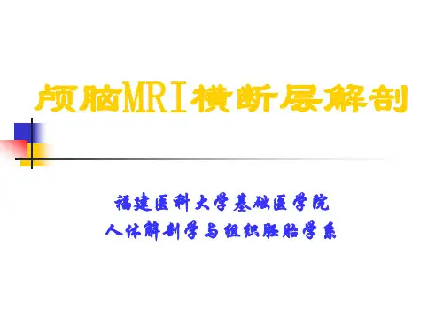 颅脑MRI横断层解剖