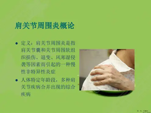 肩关节周围炎针灸治疗