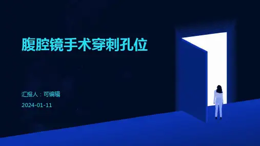 腹腔镜手术穿刺孔位