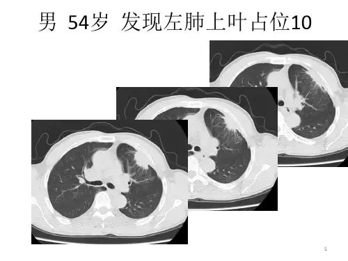 病例随访肺部占位课件