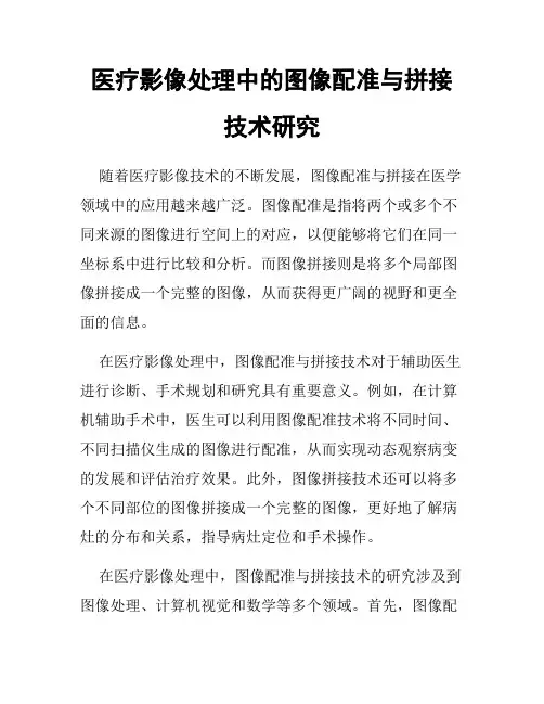 医疗影像处理中的图像配准与拼接技术研究