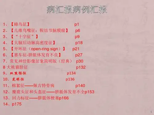 神经系统影像典型征象ppt学习课件