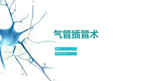 气管插管术