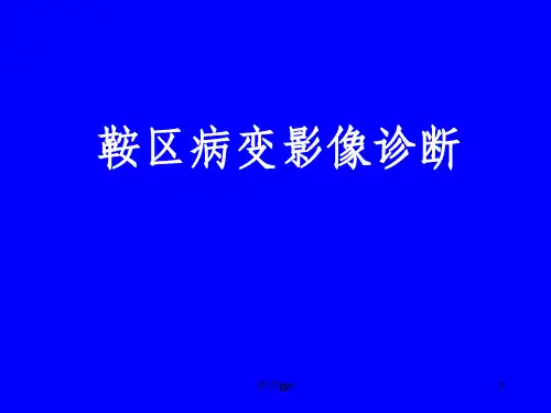 鞍区病变影像诊断_(上)